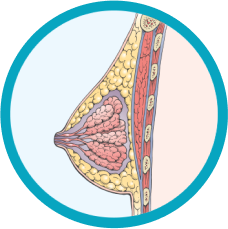 Breast before augmentation